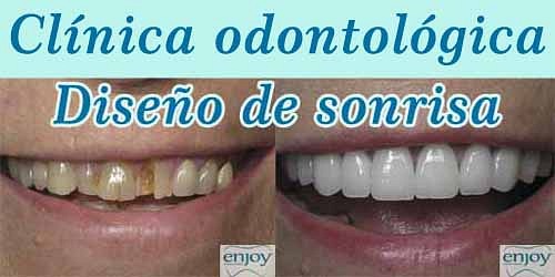 CLINICA ODONTOLOGICA ENJOY AL SUR DE CALI