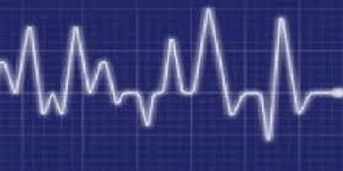 CARDIOLOGO CLINICO - DR. GONZALO SANZ D.