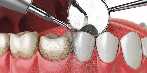 AGDE DENTAL Consultorio Dental 
